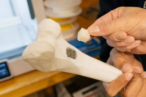 Restor3D запускає Ossera AFX для 3D-друку кісткових імплантатів