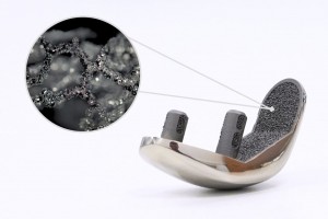 Biofuse від Croom Medical