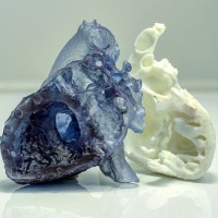 Axial3D збирає на розвиток технології 3D-медичної візуалізації