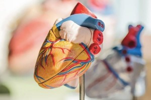 Cardiopatch, проєкт, заснований на 3D-друці для лікування проблем із серцем